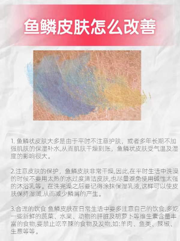 鱼鳞病怎么才能根治日常鱼鳞皮肤护理方法